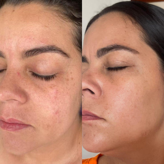 Kit Vitamina C + Hidratación